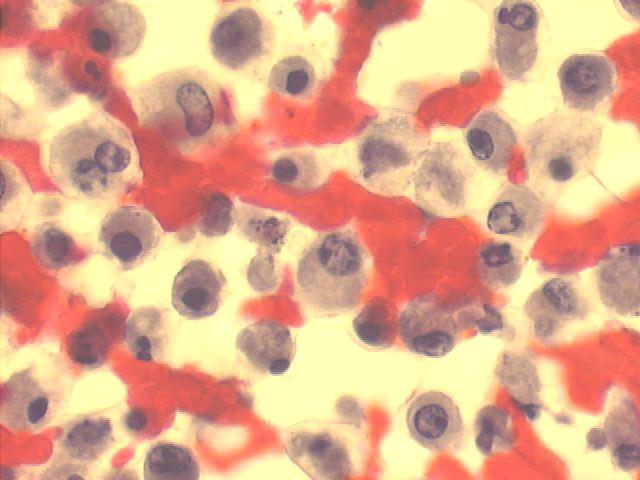 Papanicolaou staining 500x