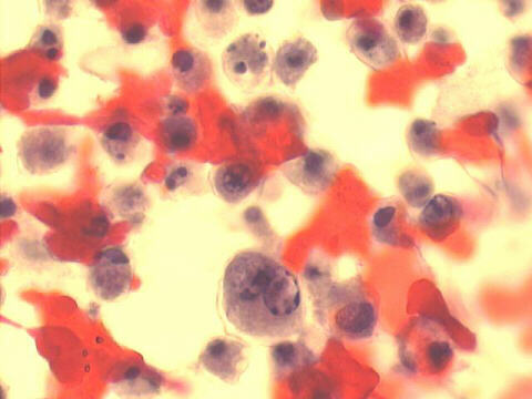 Papanicolaou staining 500x