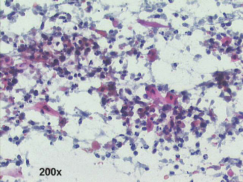 200x Papanicolaou staining