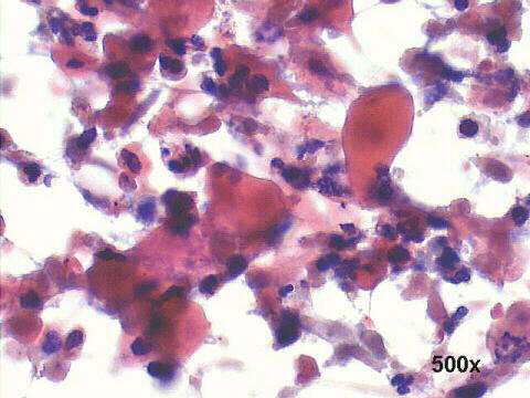 500x Papanicolaou  staining