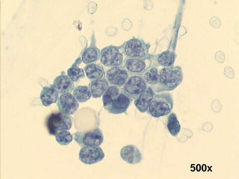 500x Papanicolaou staining