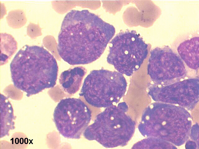 1000x M-G-G staining