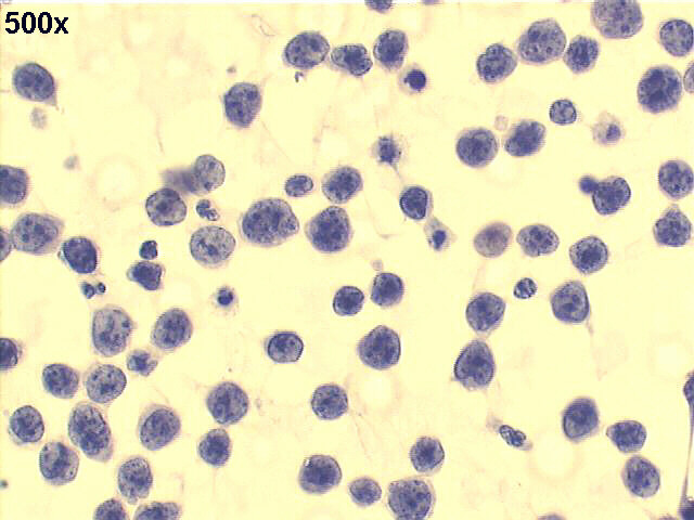 500x Pap staining