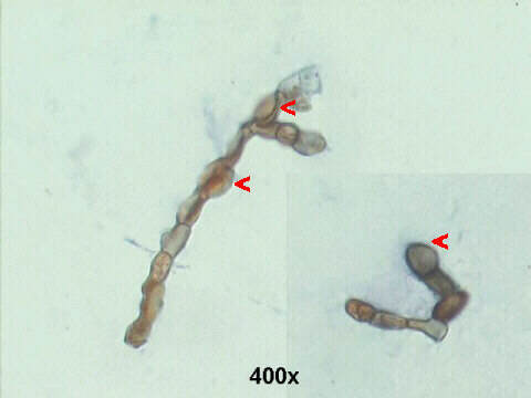 400x Papanicolaou staining, see the chlamidoconidia at the red arrow heads