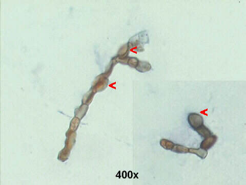 400x Papanicolaou staining