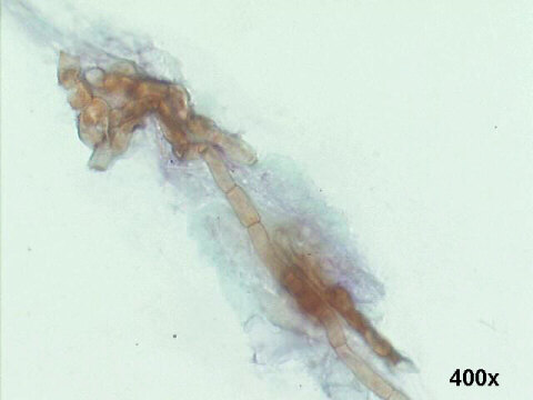 400x Papanicolaou staining