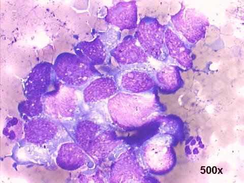 500x M-G-G staining - 2nd tap