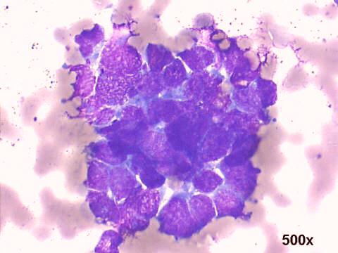 500x M-G-G staining 2nd tap