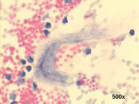 500x Papanicolaou staining