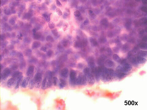 High power view of same group 500x Pap staining