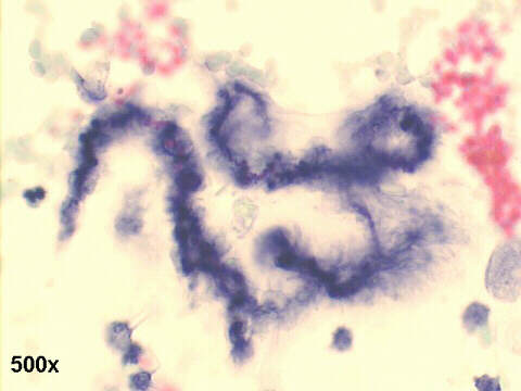 500x Papanicolaou staining