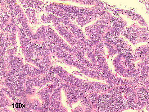 Medium power 100x H&E staining 