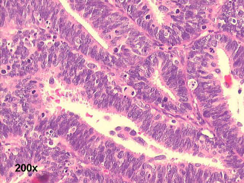 High power 200x H&E staining