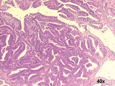 Low power 40x H&E staining