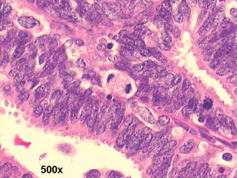 High power 500x H&E staining 