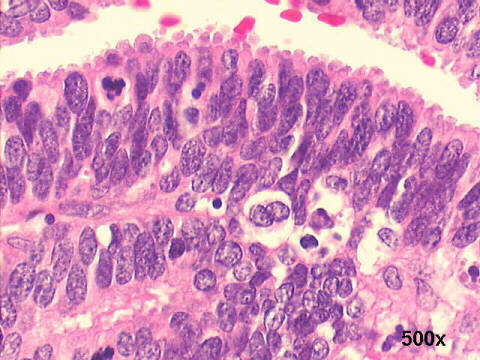 High power 500x H&E staining 