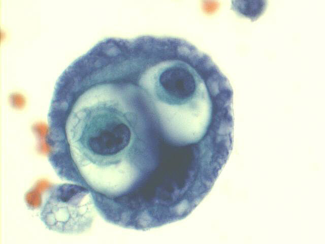 Goggle?s eyes - We now have 19 cytological curiosities!