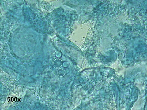 500x KOH preparation, round budding yeast with the ship's wheel appearance