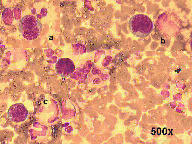500x M-G-G staining