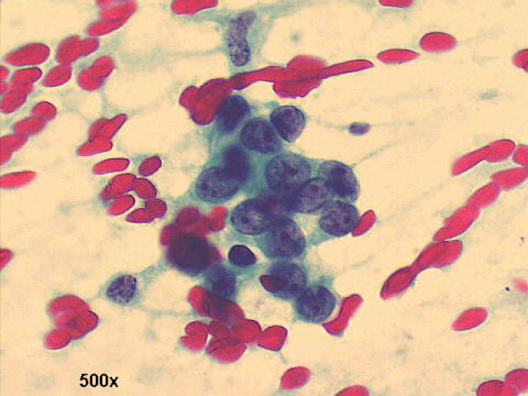 500x, Papanicolaou staining