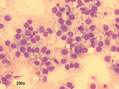 200x, M-G-G staining