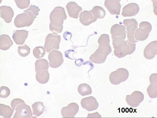 1000x M-G-G staining