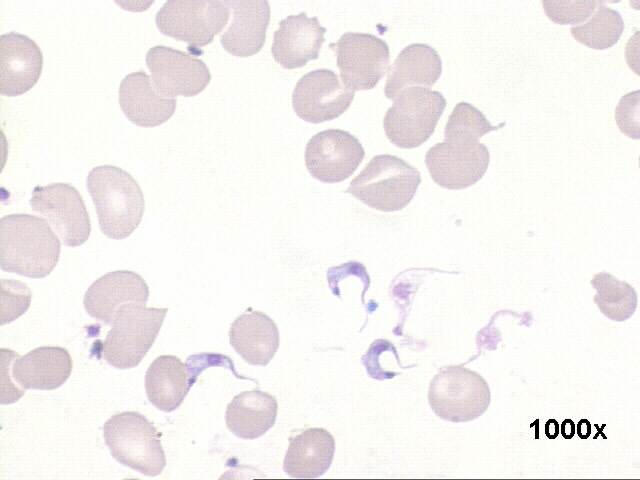 1000x M-G-G staining