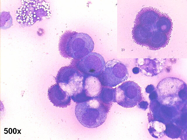 500x M-G-G staining, many cells with microvilli