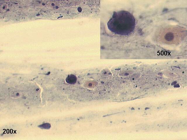 200x Papanicolaou staining