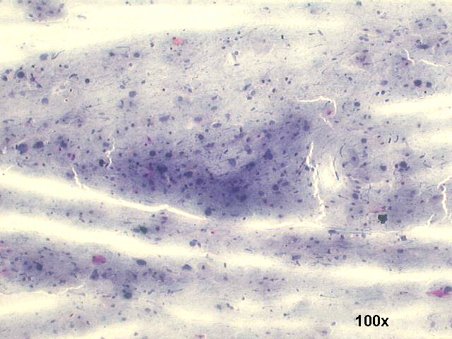 100x Papanicolaou staining
