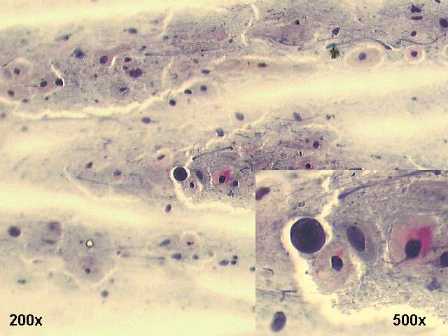 200x Papanicolaou staining