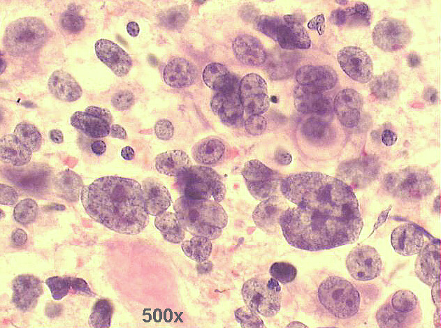 500x Pap staining