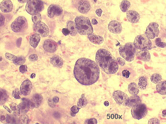 500x Pap staining
