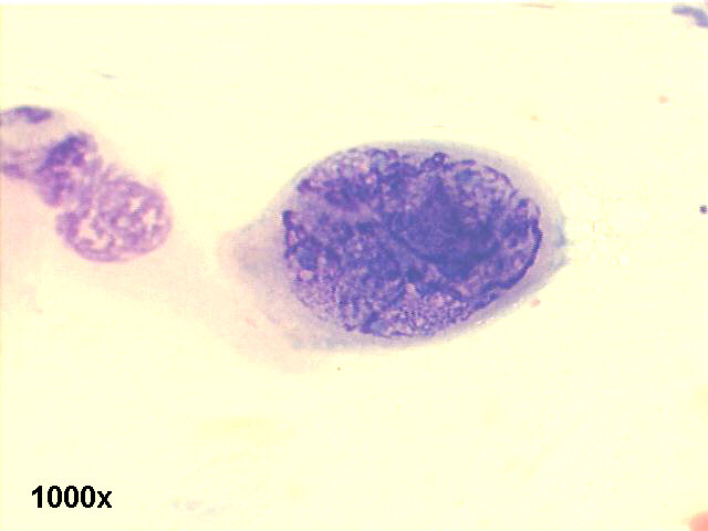 1000x M-G-G staining