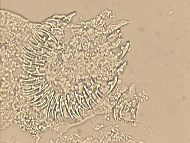 500x unstained smear