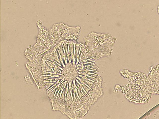 500x unstained smear