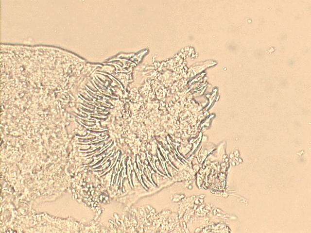 500x unstained smear, liver hydatid cyst, E. granulosus