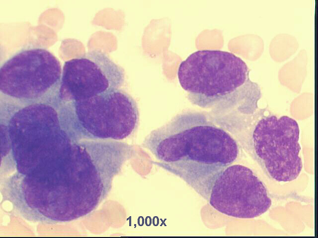 1,000x M-G-G staining