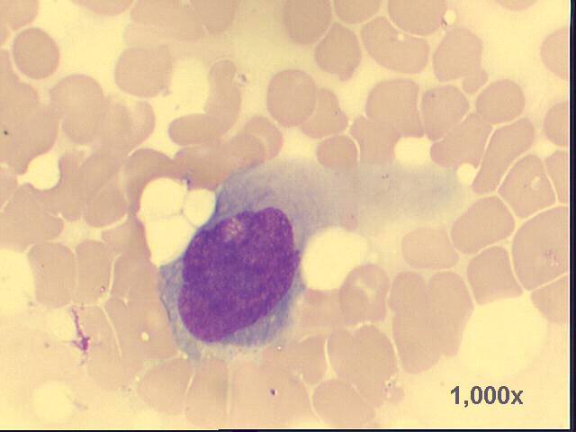 1,000x M-G-G staining