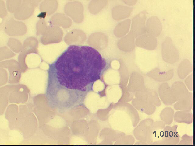 1,000x M-G-G staining