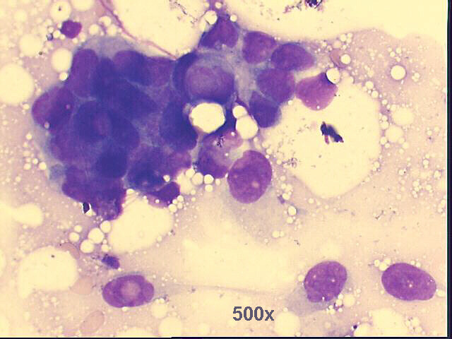 500x M-G-G staining