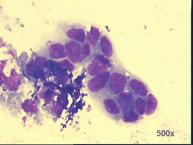 500x M-G-G staining