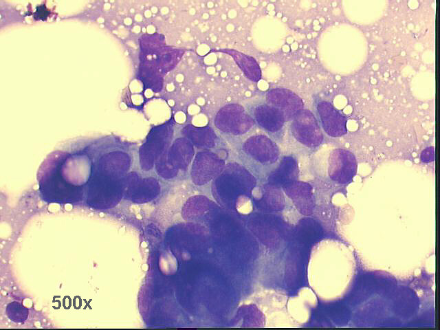 500x M-G-G staining