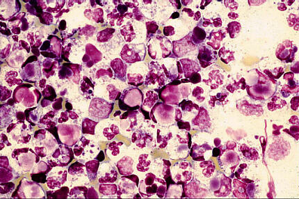 M-G-G staining