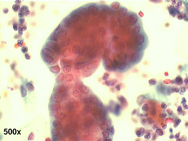 500x Papanicolaou staining