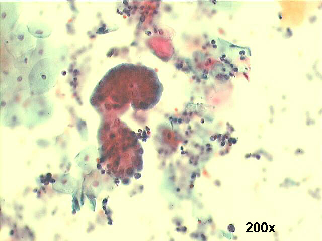 200x Papanicolaou staining