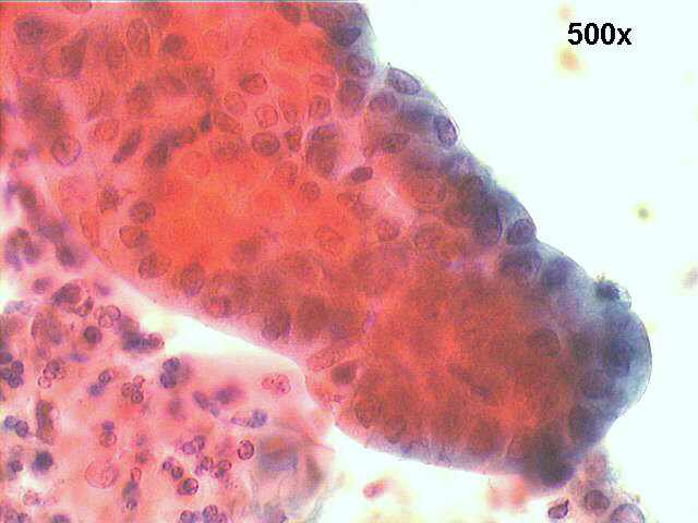 500x Papanicolaou staining