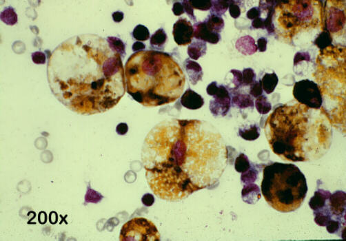 Papanicolaou  staining