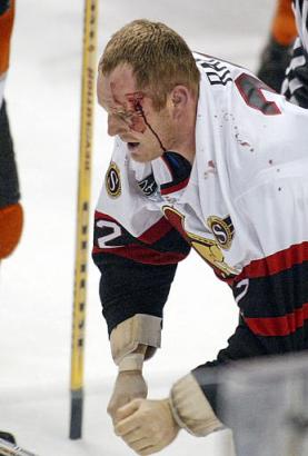 Rob Ray is a bloody mess after a fight with Flyers tough guy Donald Brashear 