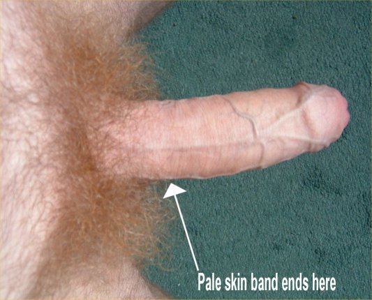 The pale skin band